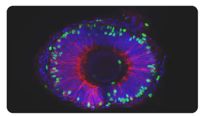 The zebrafish eye