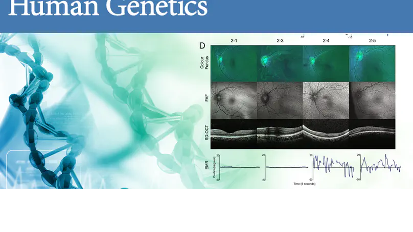 PAX6 missense variants in two families with isolated foveal hypoplasia and nystagmus: evidence of paternal postzygotic mosaicism