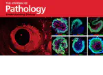 Loss of the crumbs cell polarity complex disrupts epigenetic transcriptional control and cell cycle progression in the developing retina