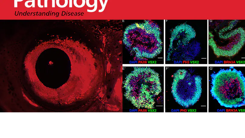 Loss of the crumbs cell polarity complex disrupts epigenetic transcriptional control and cell cycle progression in the developing retina